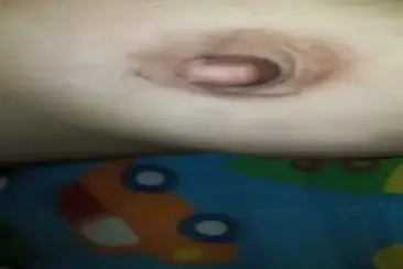 Dikenyot Sampai Senjata Pria Melempem